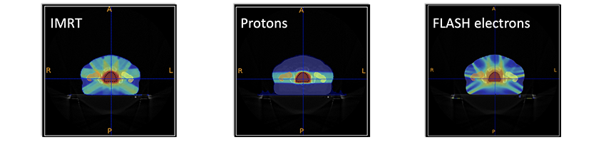 simulation of treatment plans in FRIDA